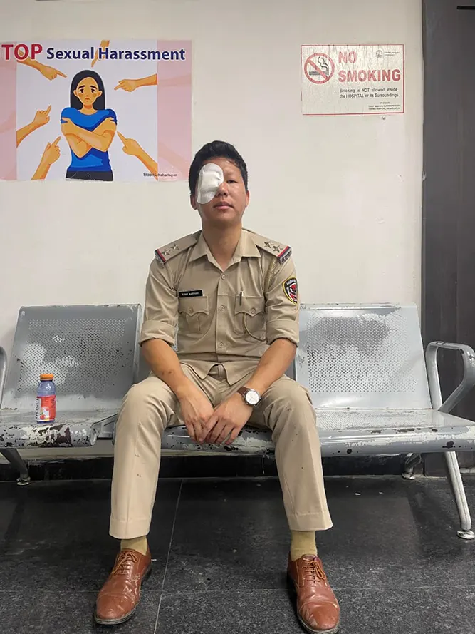SI suffers severe eye injury after stone pelting during bandh